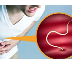 Гельминтоз