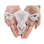 Гинекологические заболевания