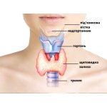 Болезни щитовидной железы