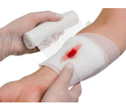 Кровотечения