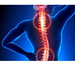 Остеохондроз