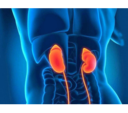 Пиелонефрит