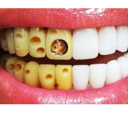 Пародонтоз