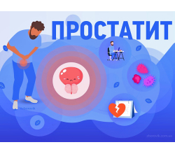 Простатит