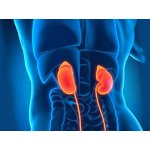 Пиелонефрит